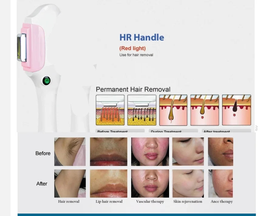Portable 360 magneto-optical IPL painless hair removal machine