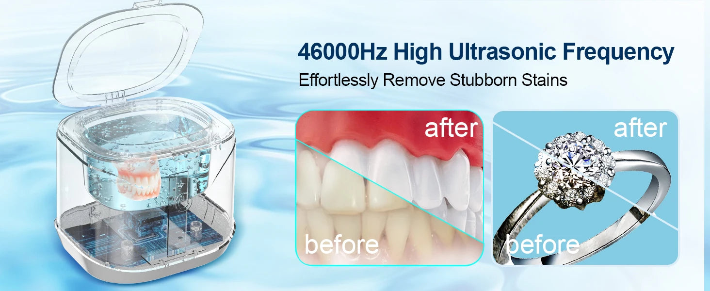 KUNPHY 46kHz Ultrasonic Cleaner Mini Portable Washing Machine Timer Ultrasound Bath Sonic Cleaning Devices for Dentures Aligner