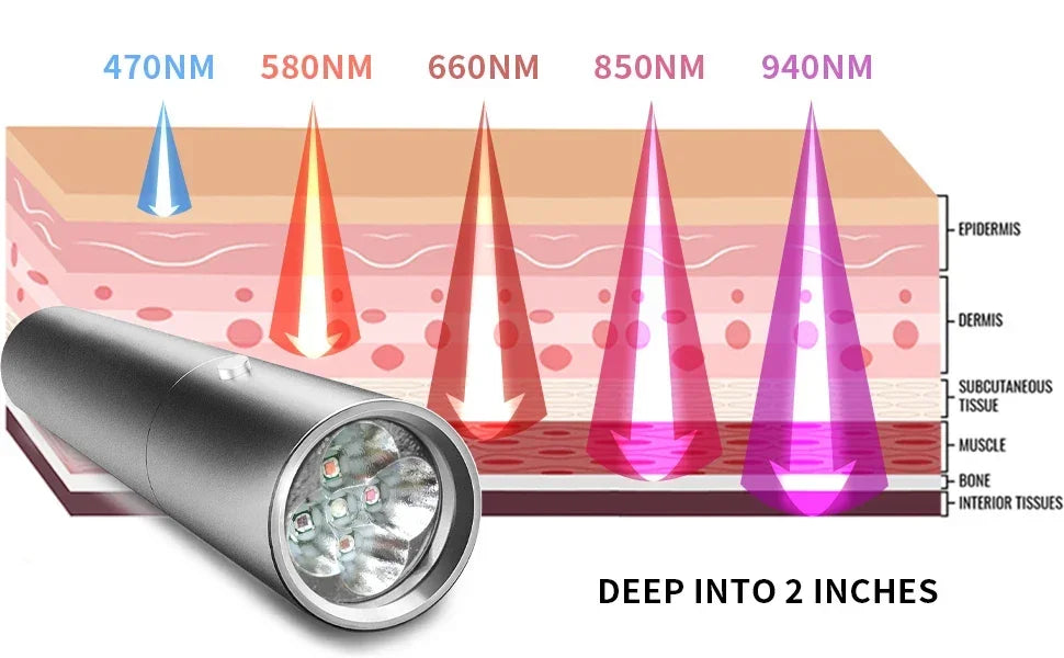 Red Light Therapy Device Cold Laser Physical Treatment 5 Wavelengths Near Infrared 940nm Light Therapy Skin Health Body Pain