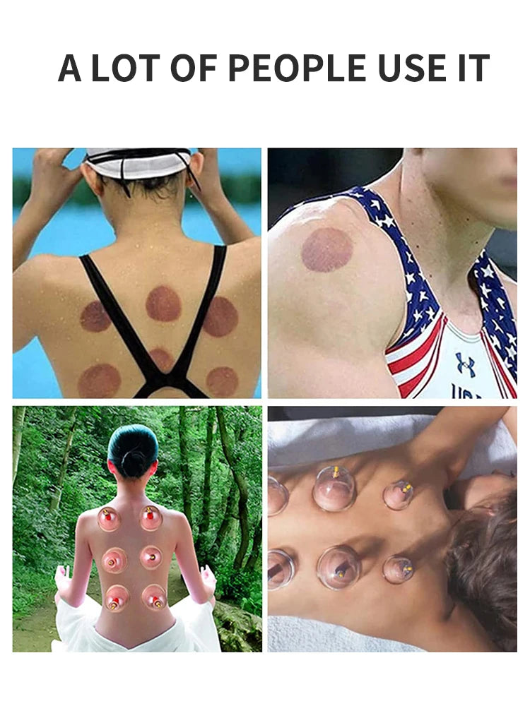 32 Can Household Thickened Vacuum Cupping Machine Non Glass Cupping Machine Health Cupping Machine Massage Tool