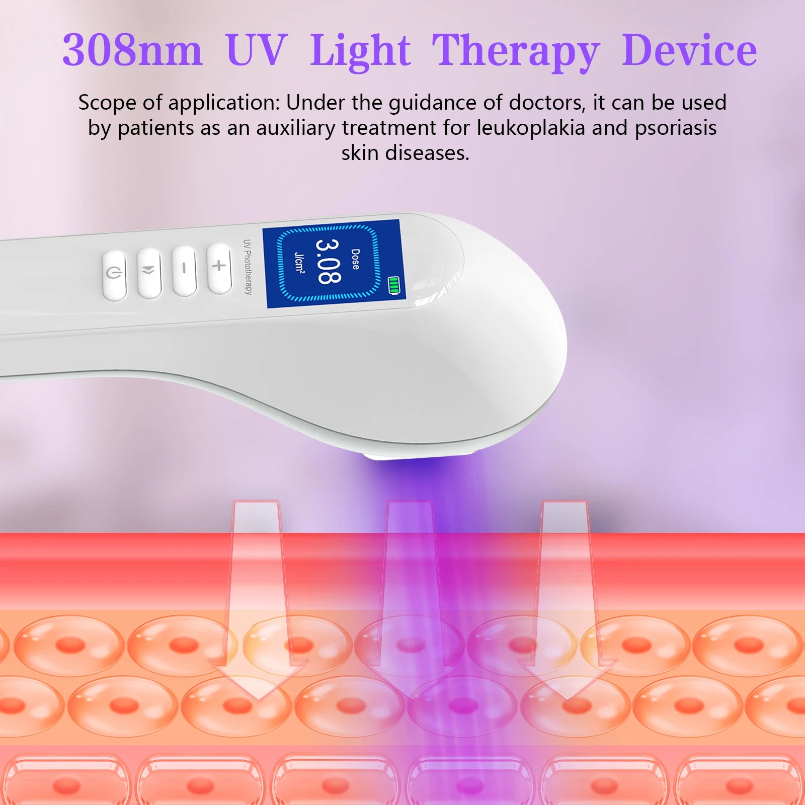 308nm Household Ultraviolet Phototherapy Instrument, Vitiligo Treatment, UVB Lamp Laser for Therapy, Psoriasis, Skin Disease