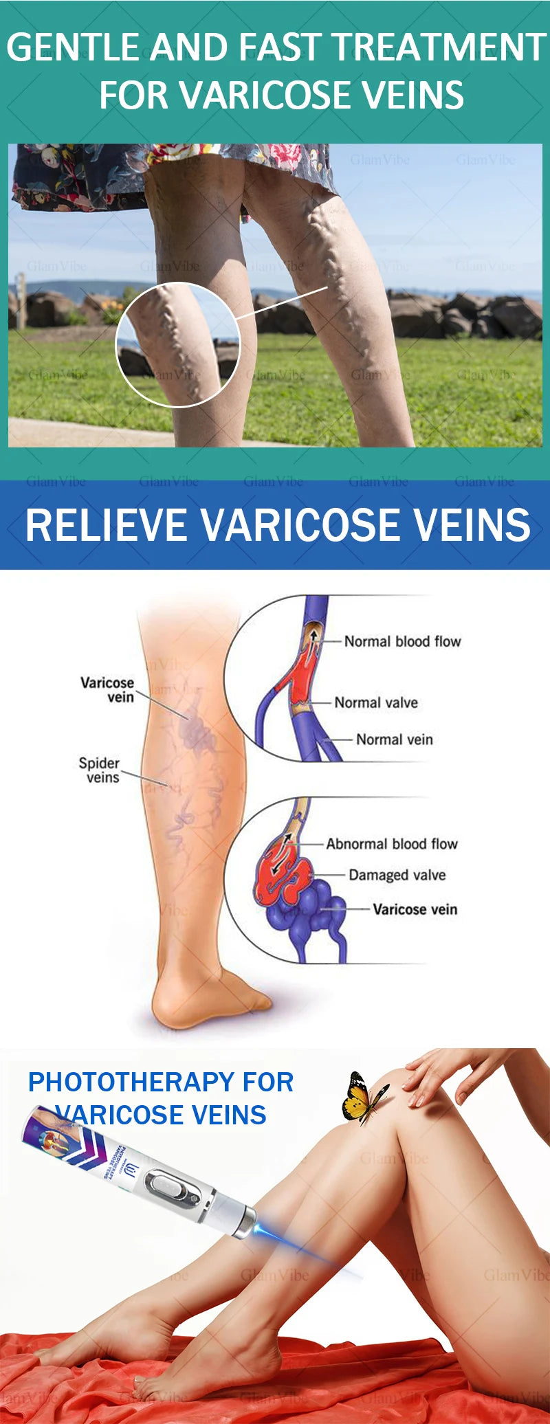 2025 Hᴏᴛ Sᴇʟʟɪɴɢ Pʀᴏᴅᴜᴄᴛs: Vein Leg Massager, Upgraded Second Generation, Blue Light Laser Tool Root Repair
