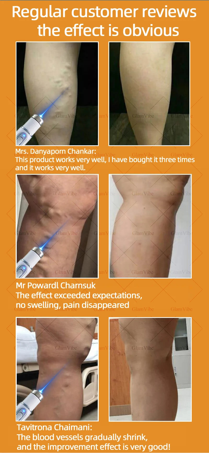 2025 Hᴏᴛ Sᴇʟʟɪɴɢ Pʀᴏᴅᴜᴄᴛs: Vein Leg Massager, Upgraded Second Generation, Blue Light Laser Tool Root Repair