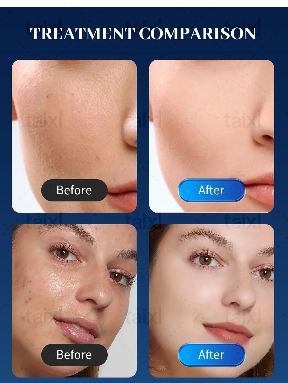 Professional Morpheus 8 RF Microneedling Machine Facial Skin Care Beauty With12 24 40 Nano Pin Cartridge