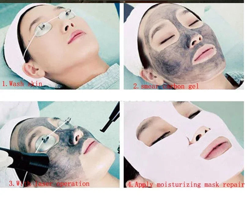 300ml Soft Laser Black Doll Carbon Cream Laser Powder Carbon Gel for Nd Yag Laser Skin Rejuvenation Treatment