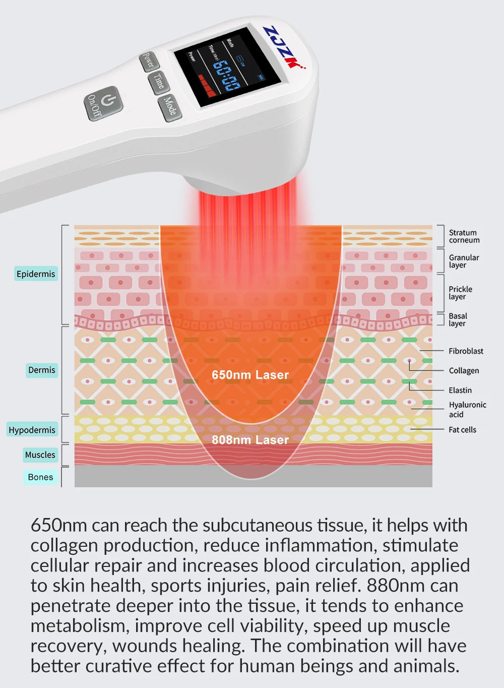 ZJZK Professional Therapeutic Cold Laser Physiotherapy Relax Treatment Massager Laser Therapy Device 808nm 650nm 880mW for Pain