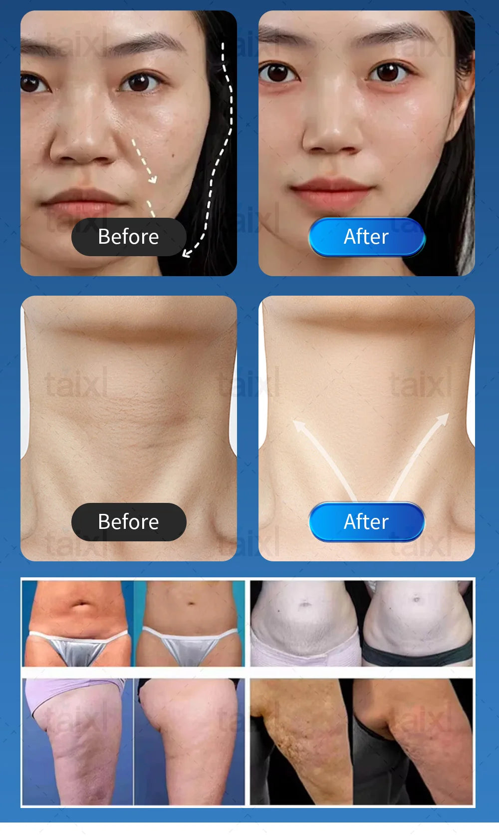 Professional Morpheus 8 RF Microneedling Machine Facial Skin Care Beauty With12 24 40 Nano Pin Cartridge