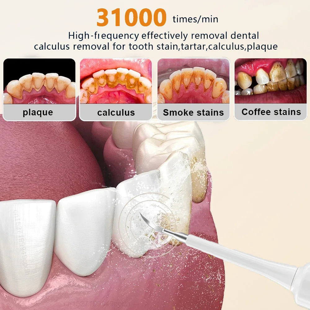 Sonic Electric Toothbrush - Dual purpose dental cleaner, home portable calculus removal care and toothbrush tool