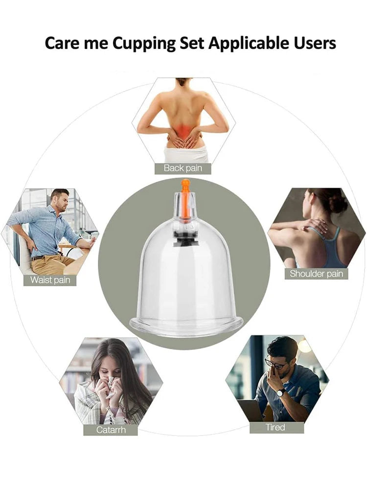 32 Can Household Thickened Vacuum Cupping Machine Non Glass Cupping Machine Health Cupping Machine Massage Tool