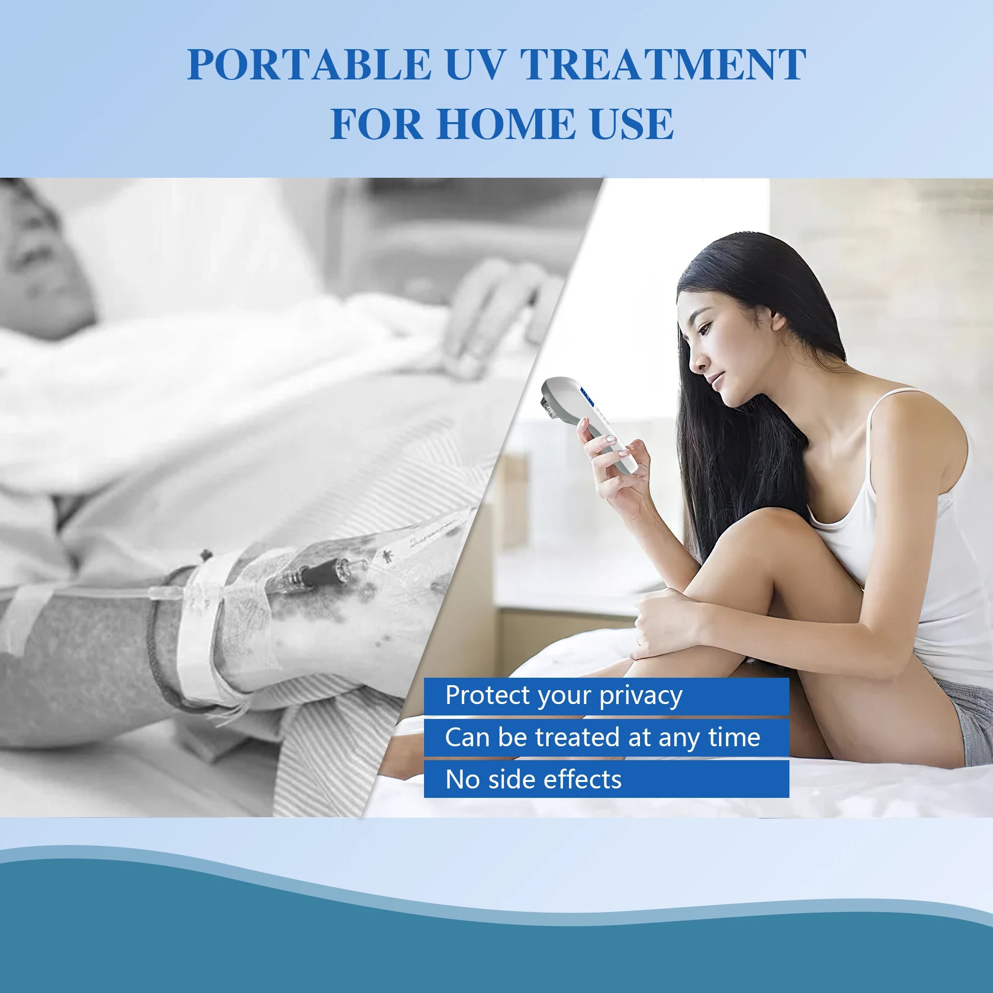 308nm Household Ultraviolet Phototherapy Instrument, Vitiligo Treatment, UVB Lamp Laser for Therapy, Psoriasis, Skin Disease