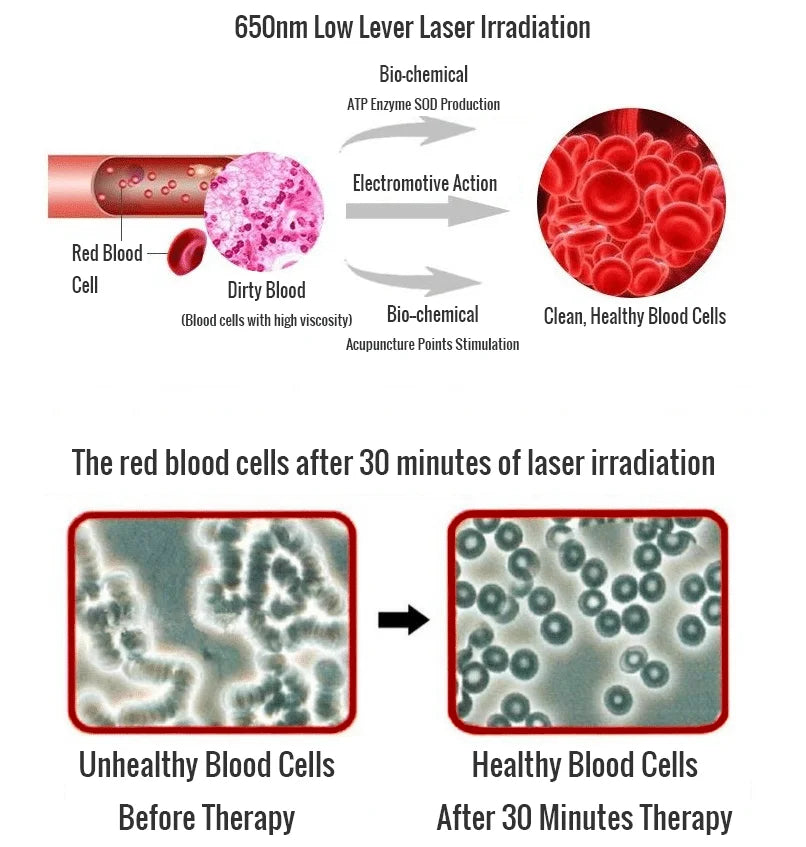 Hypertension Laser Therapy Watch Semiconductor Blood Irradiation Laser Treatment Instrument 650nm Acupuncture Points Watch