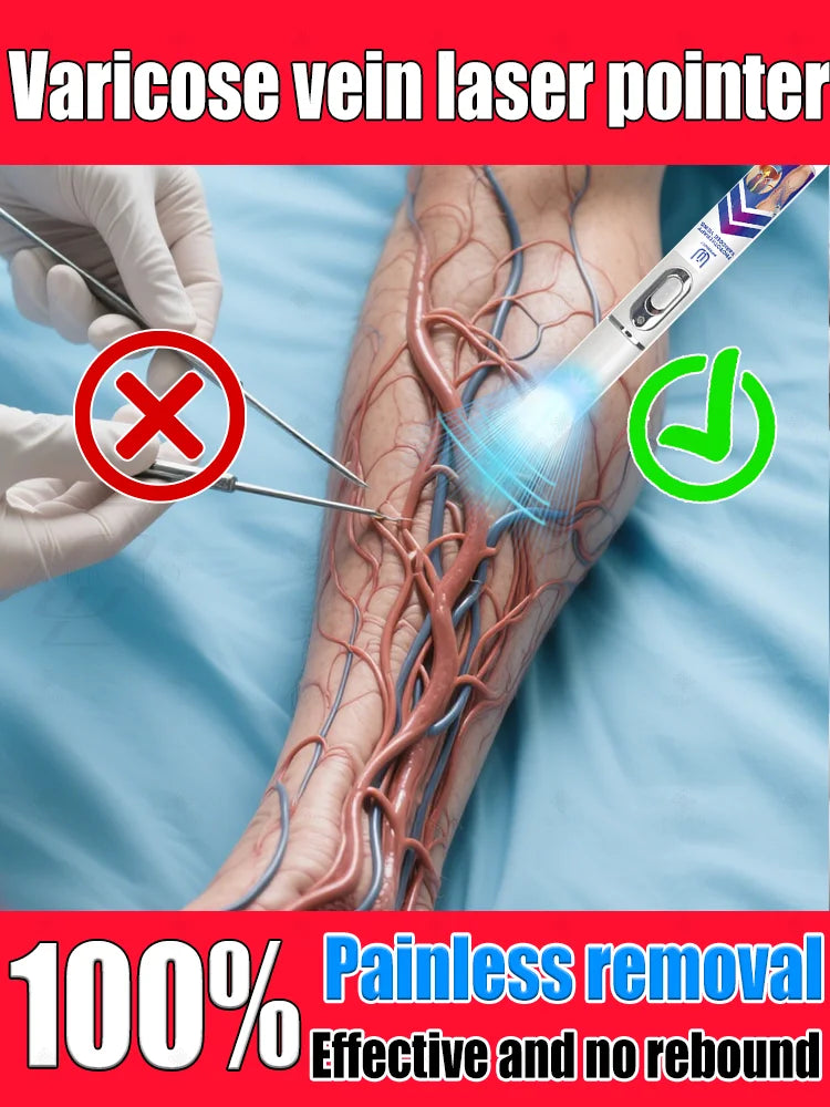 Reverse leg health in 7 days and say goodbye to varicose vein recurrence