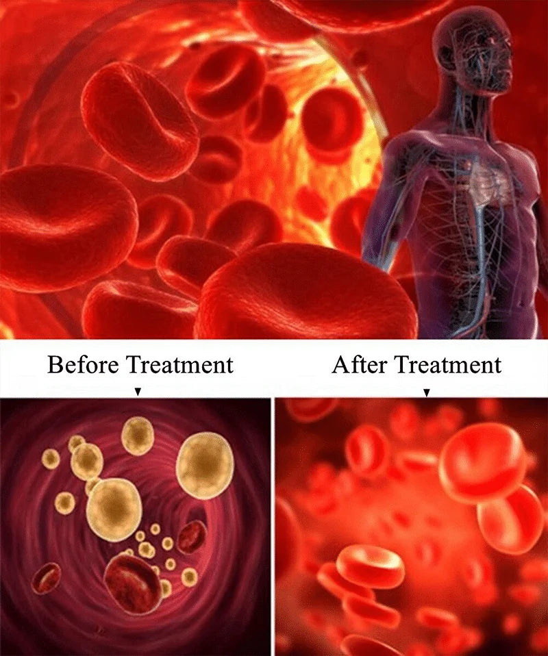 Hypertension Laser Therapy Watch Semiconductor Blood Irradiation Laser Treatment Instrument 650nm Acupuncture Points Watch