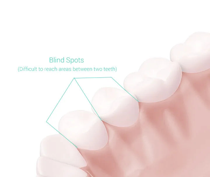 XIAOMI MIJIA T300 Sonic Electric Toothbrushes,One Charge For 25 Days,IPX7 Waterproof Rechargeable Toothbrush Whiten teeth,2 Mode