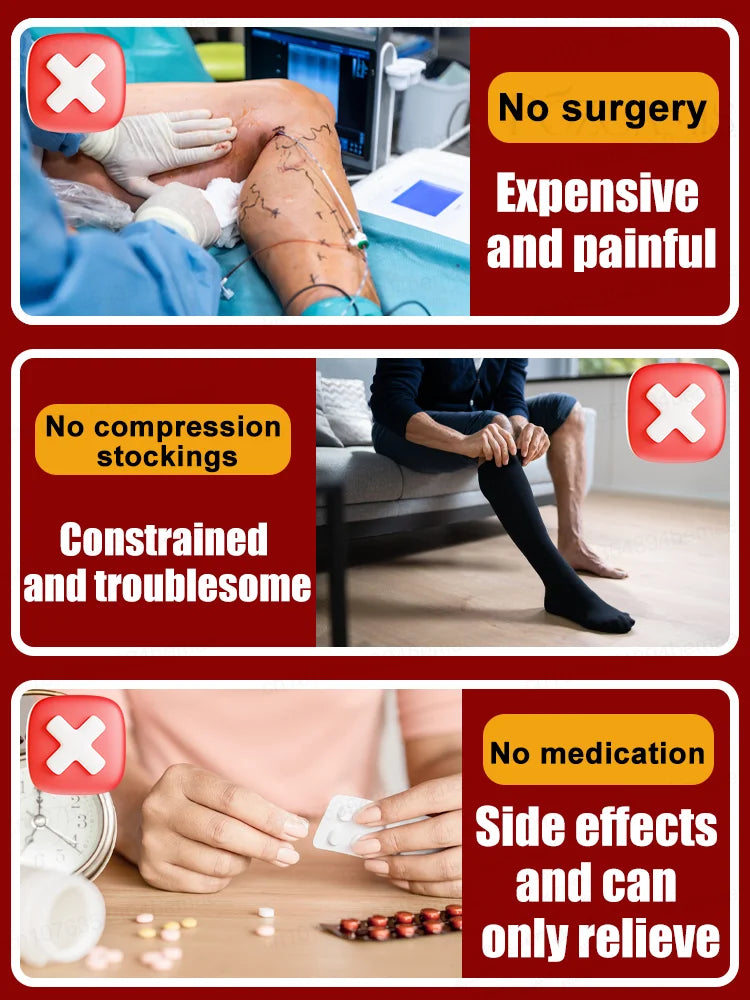 Reverse leg health in 7 days and say goodbye to varicose vein recurrence